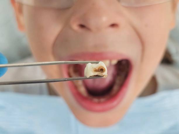 Best Emergency Dental Surgery in Kearney Park, MS